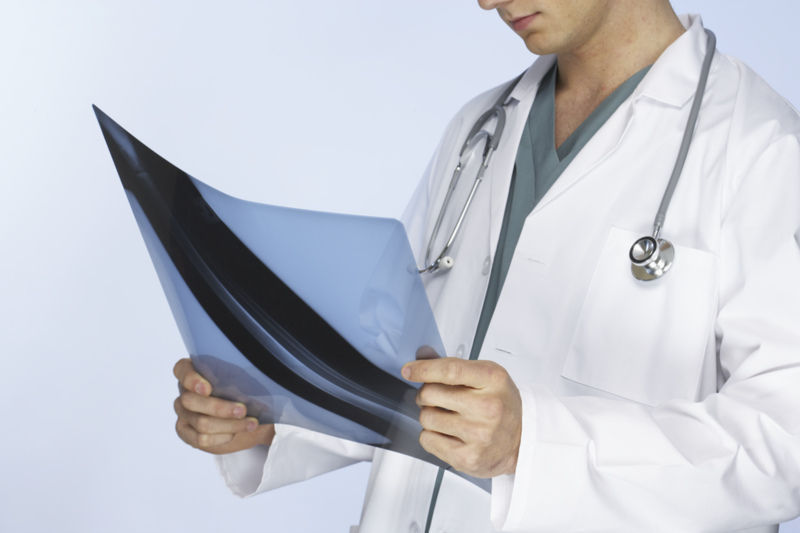 Doctor reading X-rays.