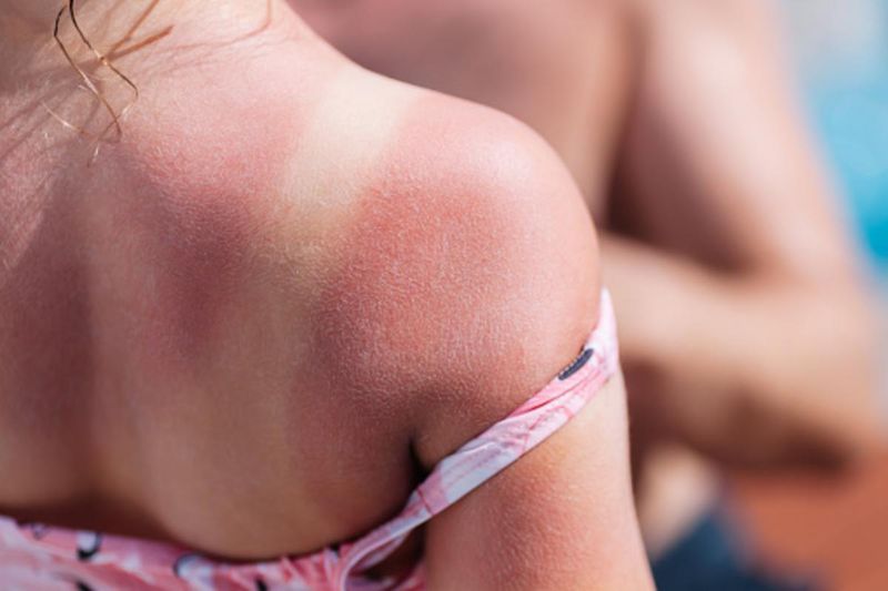 Strong UV Index Across the State