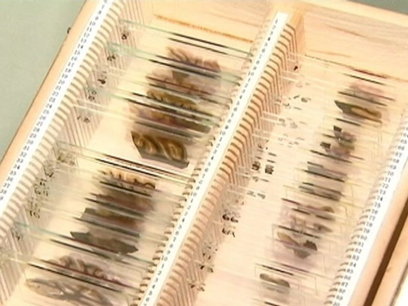 Slices Of Einstein's Brain Tissue
