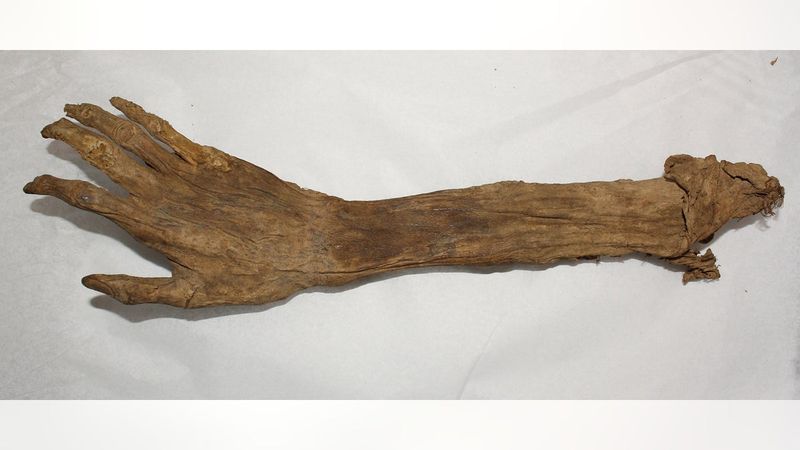 The Mummified Hand Of A Prisoner