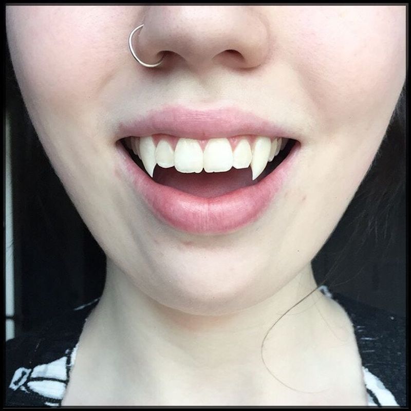 No Fake Fangs for Dentists in Alexandria