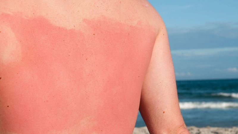 Packing Light on Sunscreen