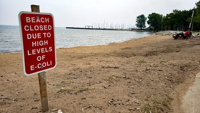 E. Coli and Bacterial Contamination