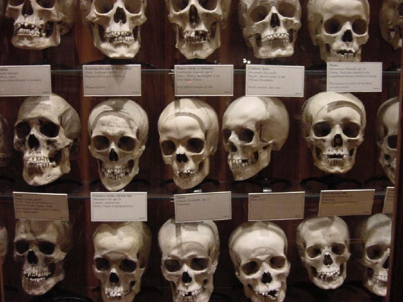 The Wall Of Skulls With Medical Conditions