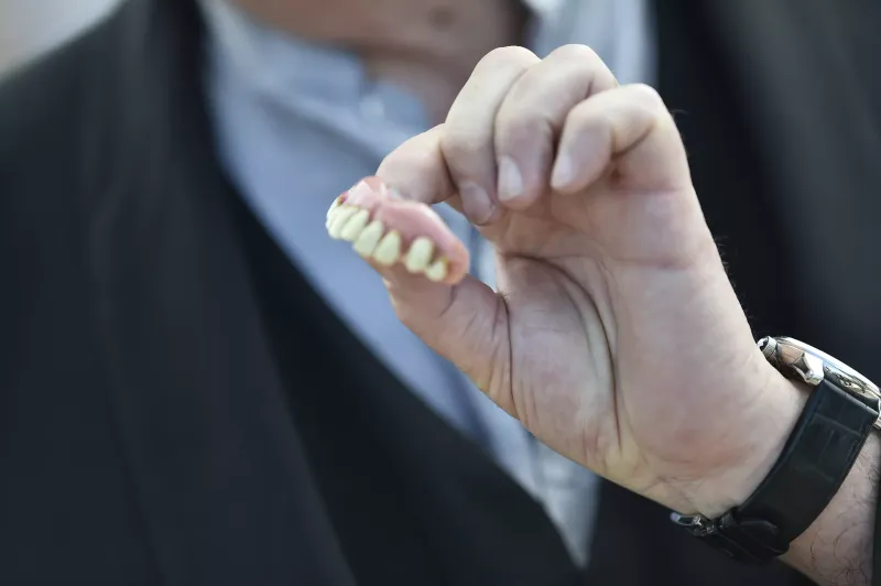 Biting Someone With Your Natural Teeth Is “Simple Battery”