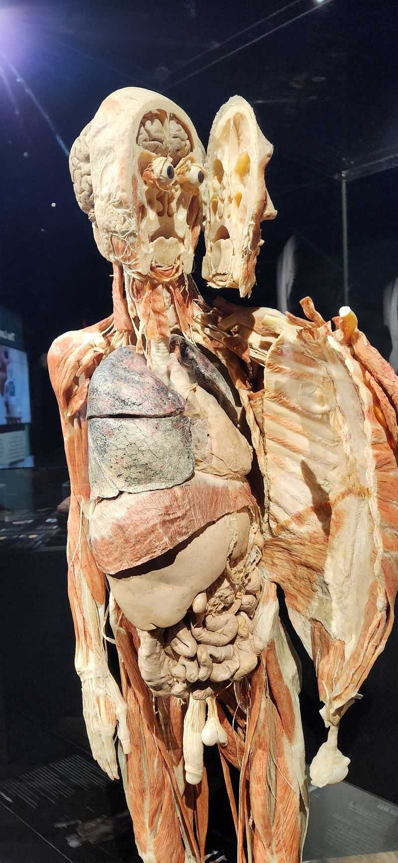 Body Worlds Exhibition Brings Anatomy to Life