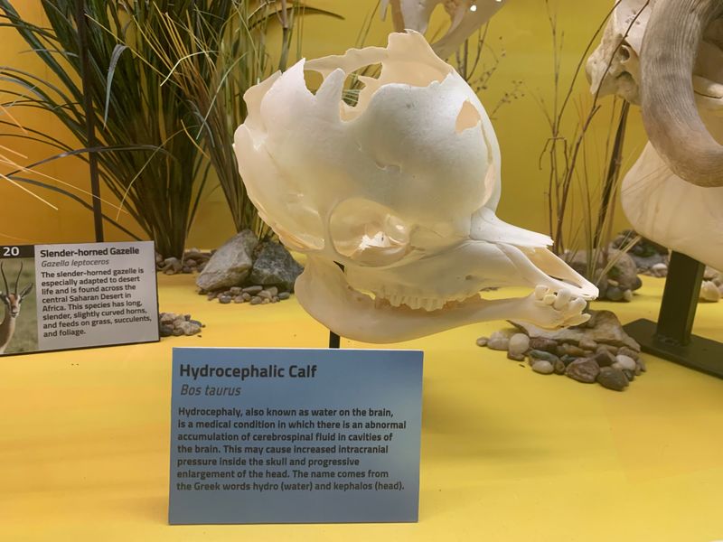 Pathology Exhibits Show What Disease and Injury Do to Bones