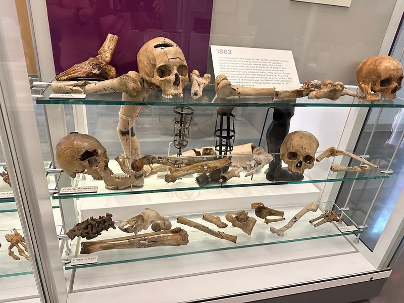 General Sickles's Preserved Leg