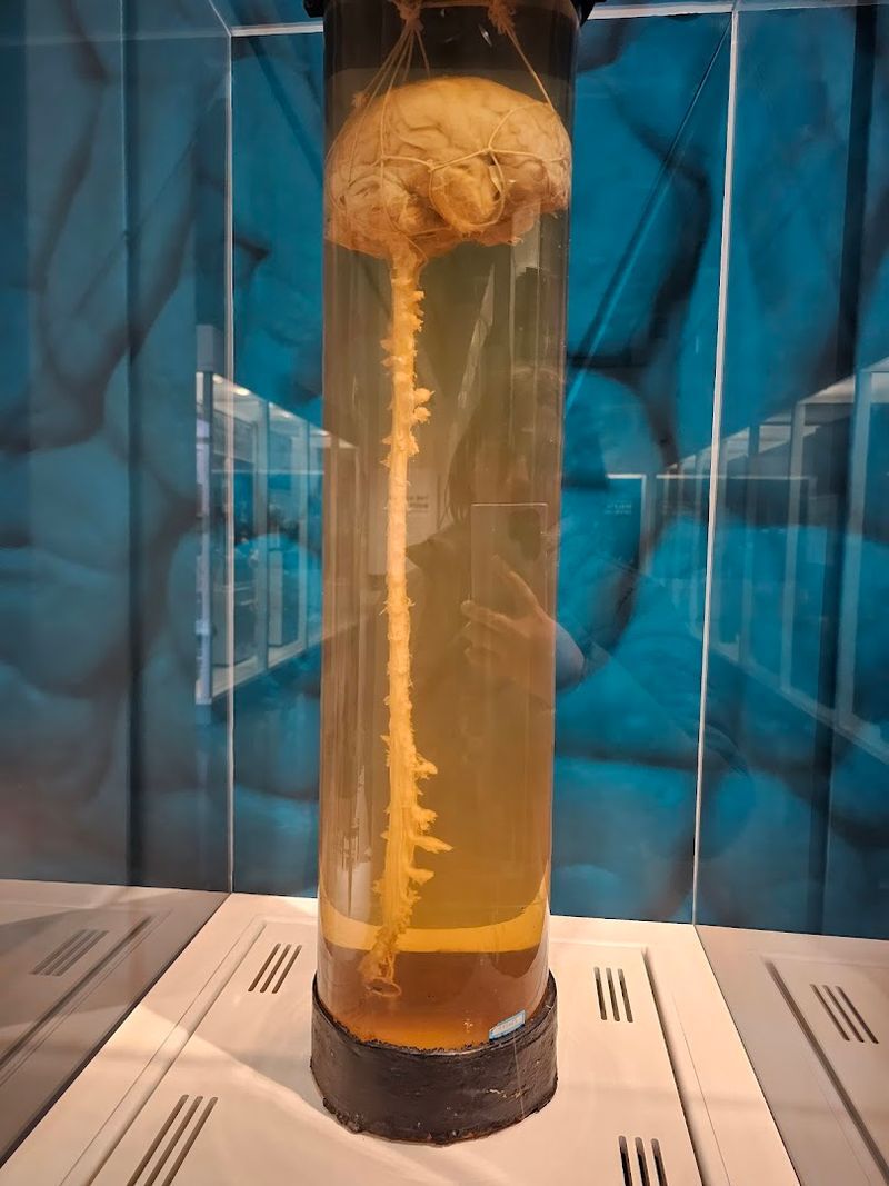 Preserved Organs and Brain Slices