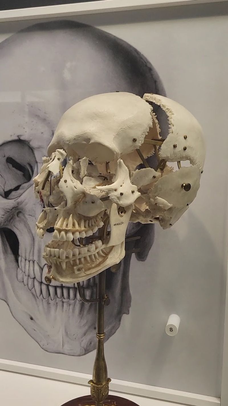 The Gilded Skull and Saint Elizabeths Lace