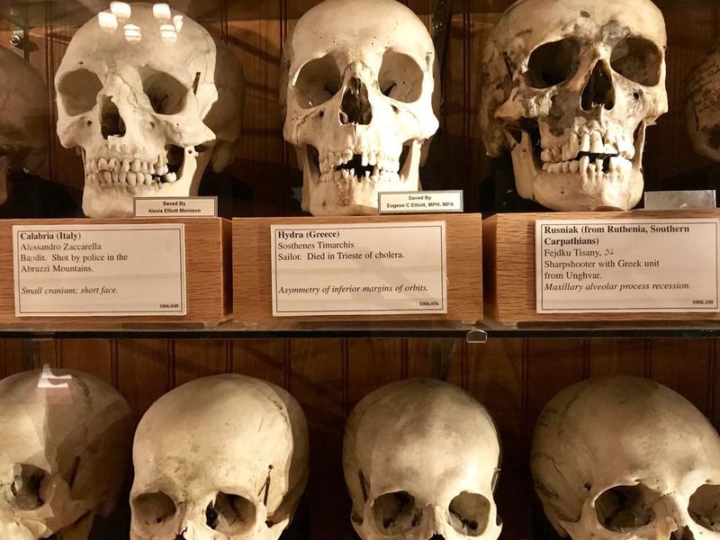 The Skull Collection Stops You Mid Step