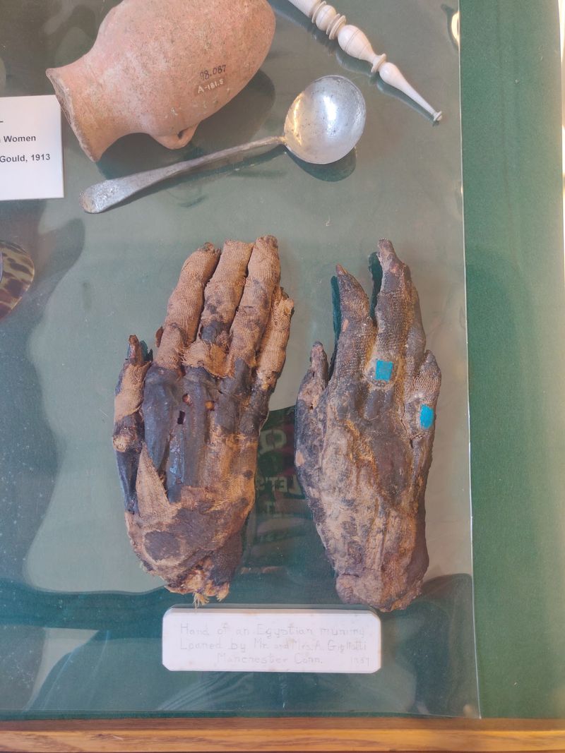 Yes, Those Really Are Mummy Hands
